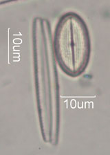 Diatom